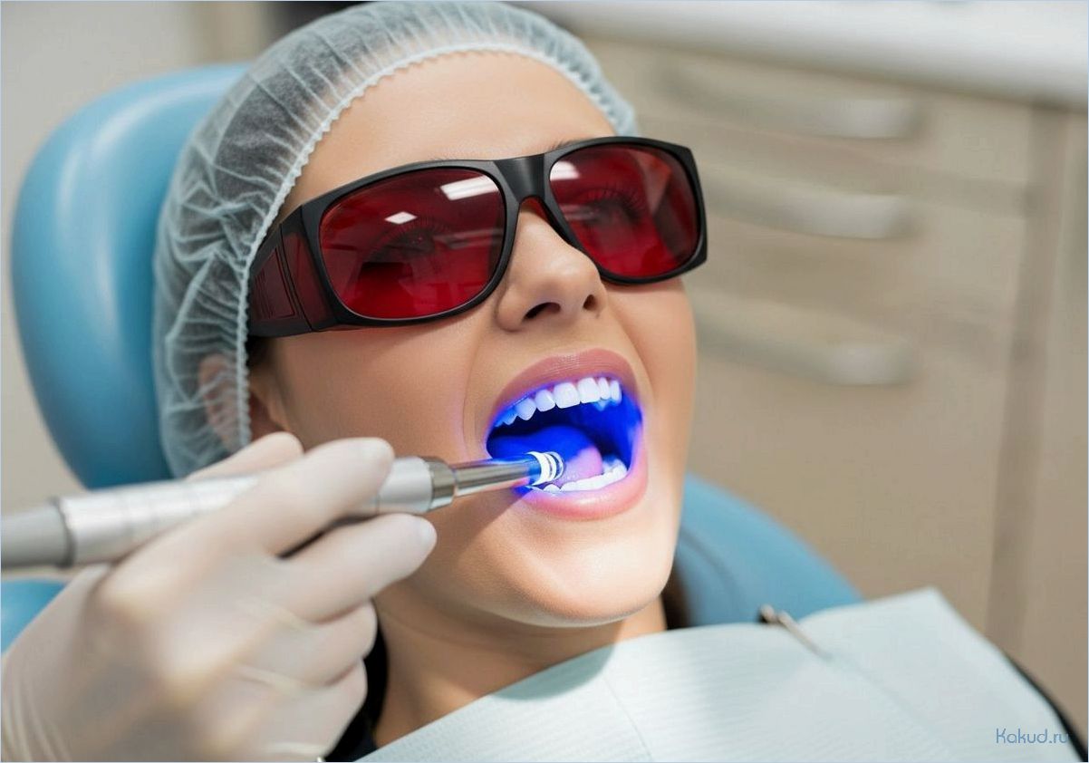 (выбор, способа, отбеливания, зубов, учитывая) Выбор способа отбеливания зубов, учитывая безопасность и результативность процедур